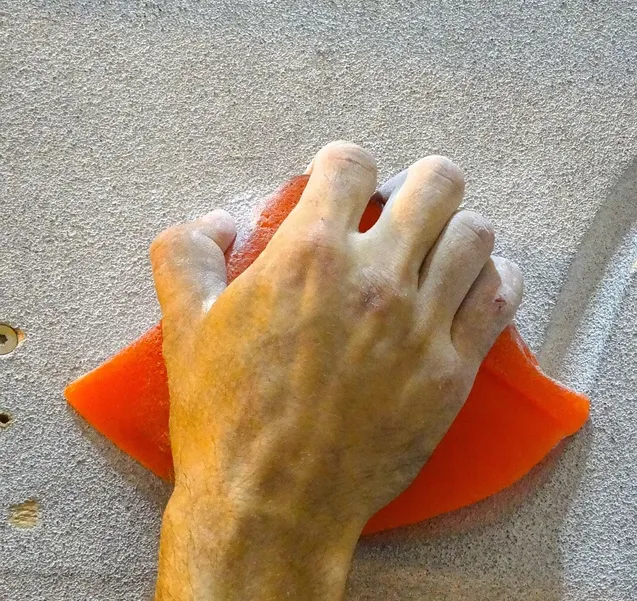 Bursitis: A common injury.