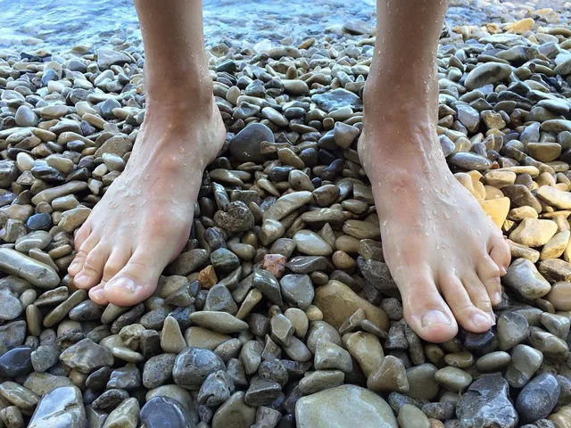 Flat feet a common problem