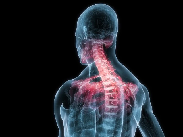 Upper Back and Neck Pain