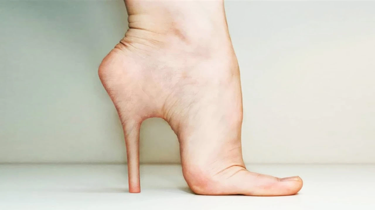 Foot Pain: Plantar Fasciitis