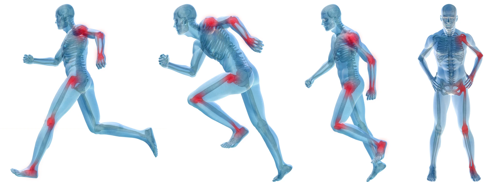Tendinopathy TOP TEN